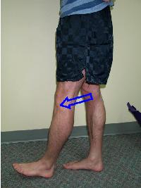 Prevention Of A Pulled Hamstring Muscle